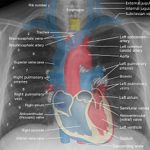 Chest X-Ray 101 (Frontal View)