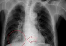 Can Artificial Intelligence effectively and ethically detect COVID-19?
